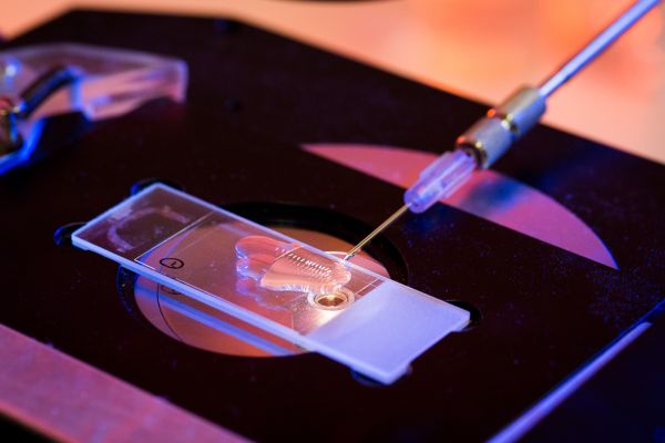 Embryo microinjection of double-stranded RNA for RNA interference (RNAi).