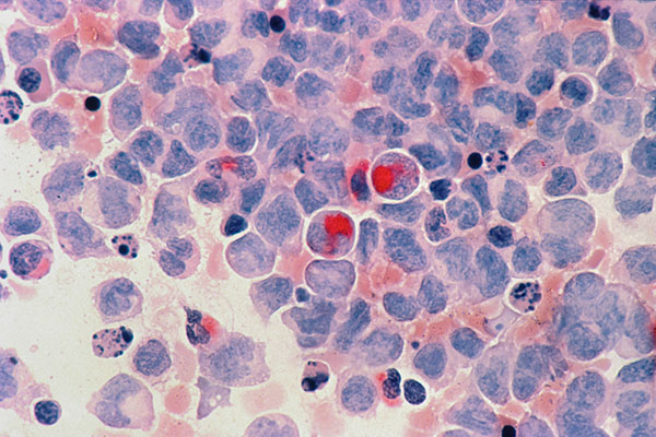 View of blood cells through microscrope