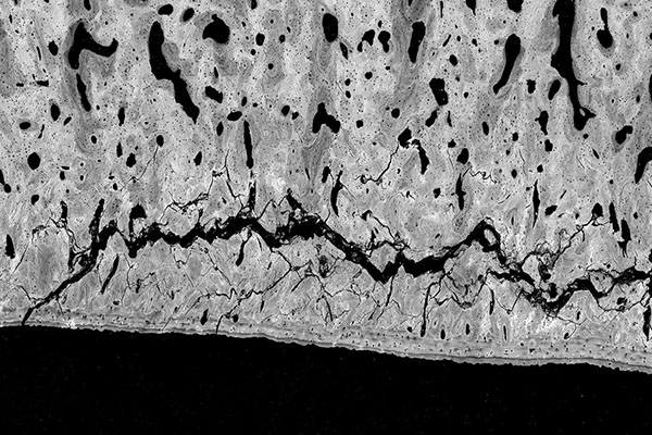 Black and white cross-section scan of a horses bone showing injury